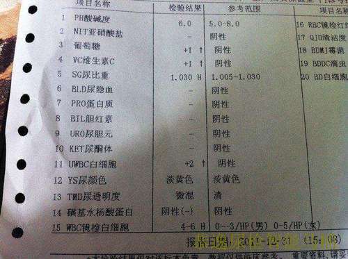 尿检智能马桶检验单